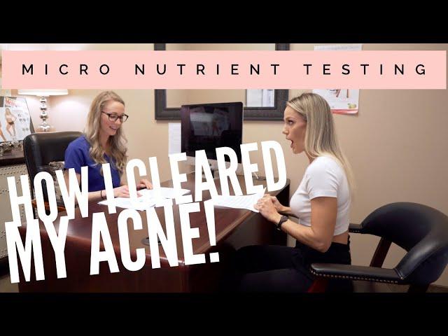 Micro Nutrient Testing CLEARED MY ACNE! l Rachel Scheer and Tawna Eubanks