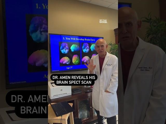 Dr. Daniel Amen Reveals His Brain Scan