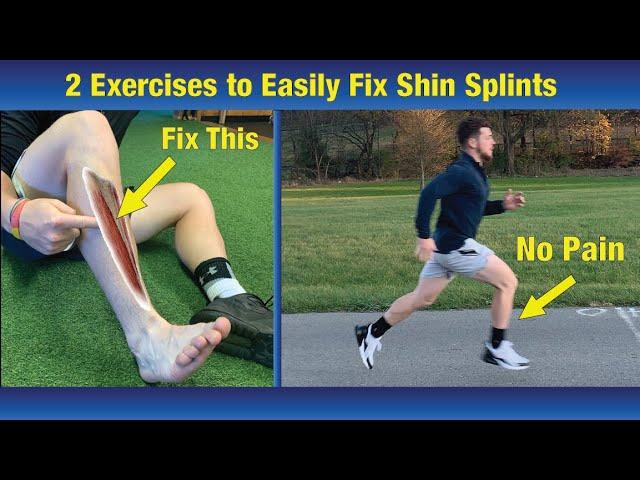 NO MORE Shin Splits - Run With Out Pain. The Complete Cure!!