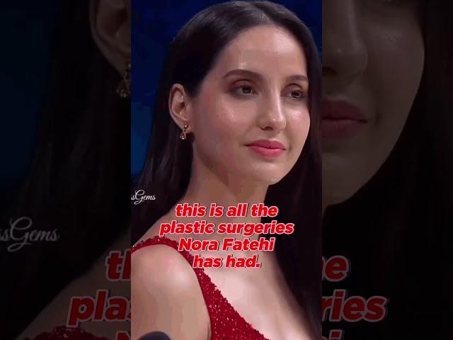 Nora Fatehi Plastic Surgeries List