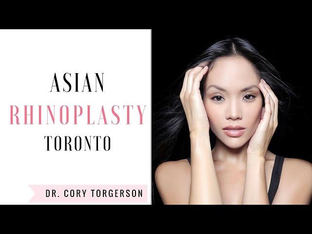 Asian Rhinoplasty | Toronto | Dr. Cory Torgerson