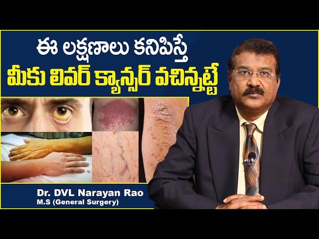 లివర్ క్యాన్సర్ లక్షణాలు || Liver Cancer Symptoms in Telugu || Dr DVL Narayan Rao || TX Hospitals