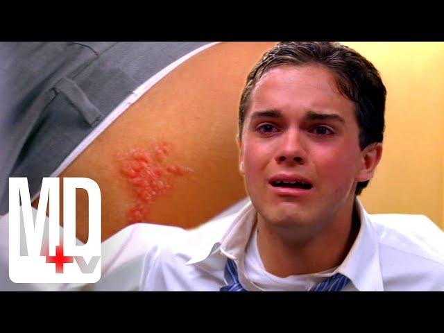 15-Year-Old Faith Healer Spreading Herpes | House M.D. | MD TV