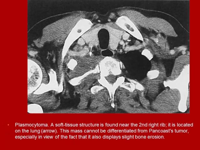 whole body computed tomography Shering Edition