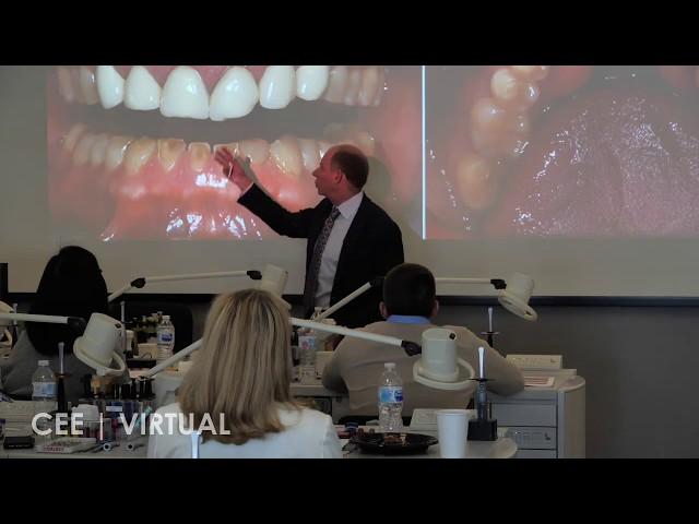 Severe Anterior Teeth Wear & Loss Of VD | Cosmedent, Inc.