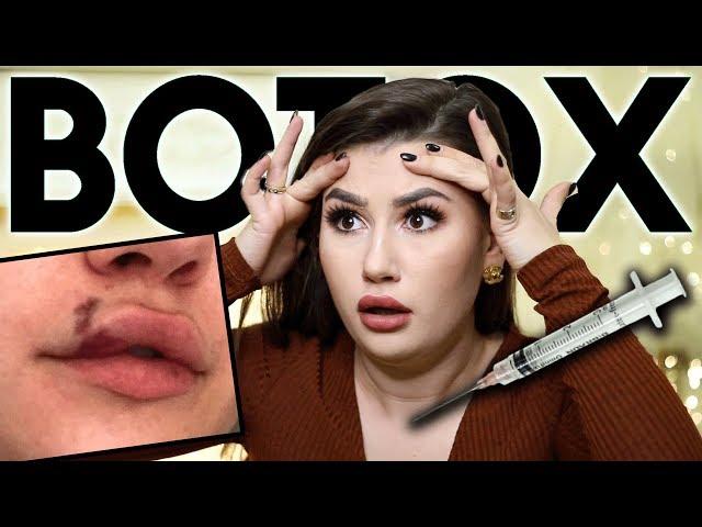 BOTOX mit 25 | Q&A Meine Beauty Behandlungen | Sara Bow