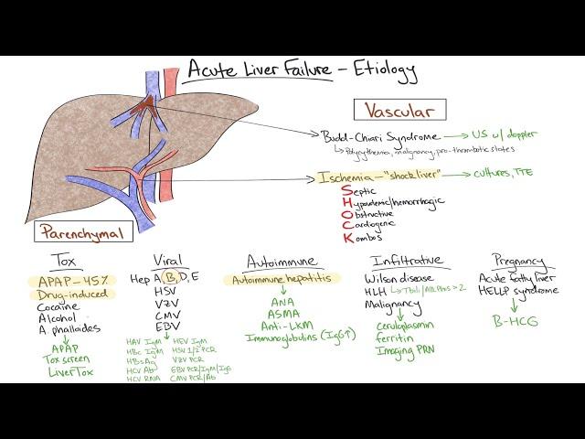 Chalk Talk: Acute Liver Failure