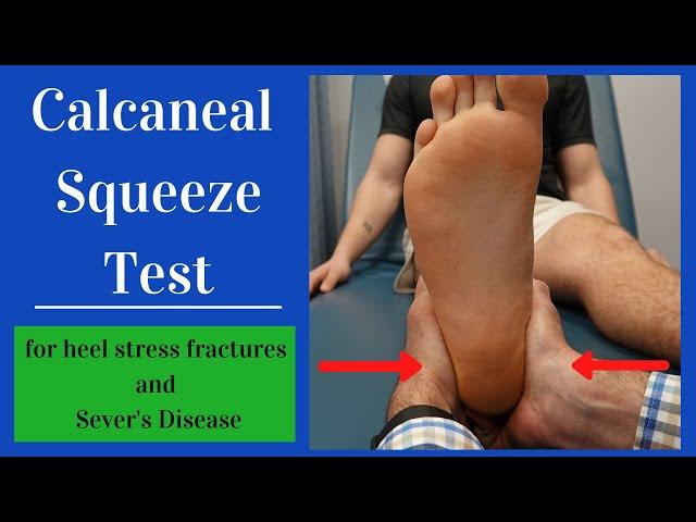 Calcaneal Squeeze Test (Heel Squeeze)