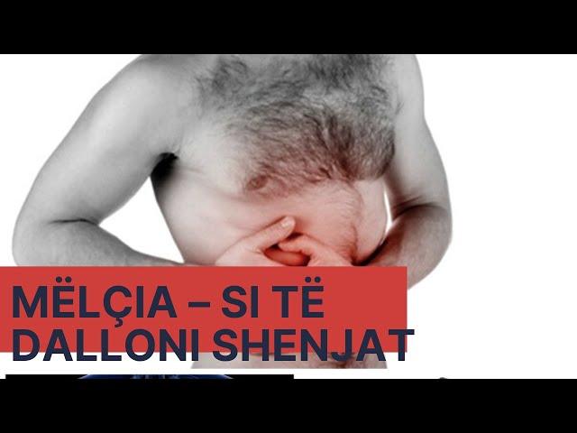 Mëlçia – Si të Dalloni Shenjat e Para të Problemeve në Organizëm