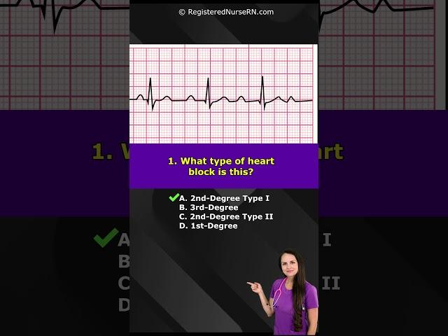 ECG / EKG Rhythm NCLEX Quiz: What Rhythm Is This? #nursing #shorts