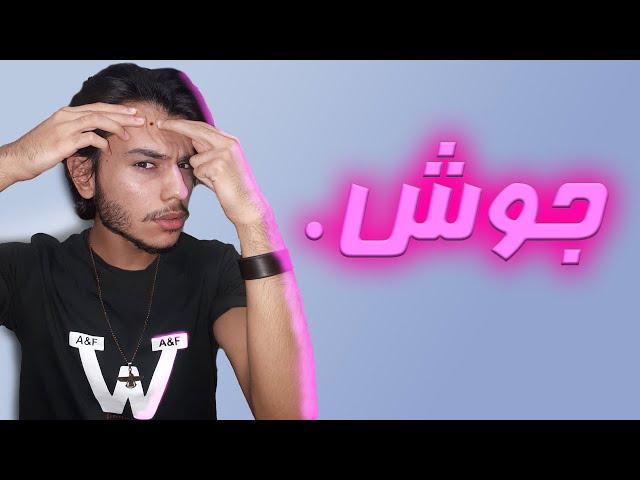 برای نوجوون هایی که صورتشون پر از جوشه!