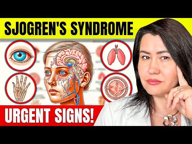 10 Alarming Sjogren's Syndrome Symptoms You Should Know