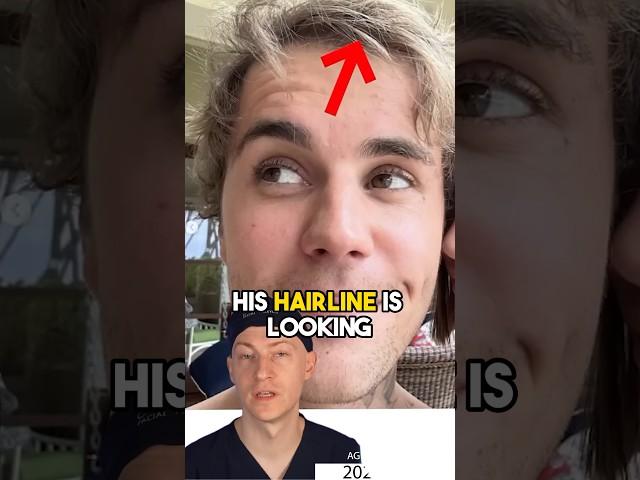 Justin Bieber’s NEW HAIR | Surgeon Analysis