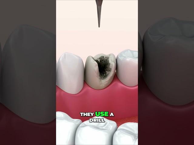 “What’s Really Hiding on Your Teeth” #shorts #viral #trending #foryou #foryoupage #viralshorts