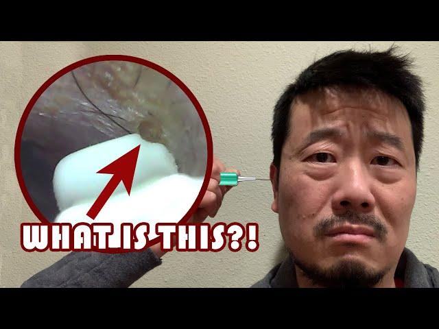 Ear wax removal cleaner with camera (Bebird C3 Review)