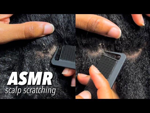 ASMR Scalp Scratching to help you relax‍️