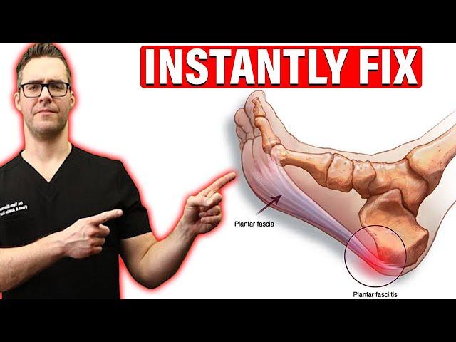 How To Cure Plantar Fasciitis FAST & FOREVER [Heel Pain & Heel Spurs]