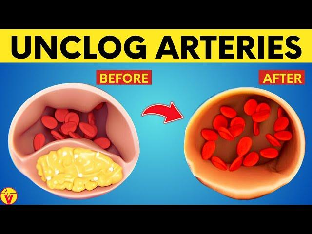 Top 11 Foods to Clean Your Arteries And Prevent Heart Attacks | VisitJoy