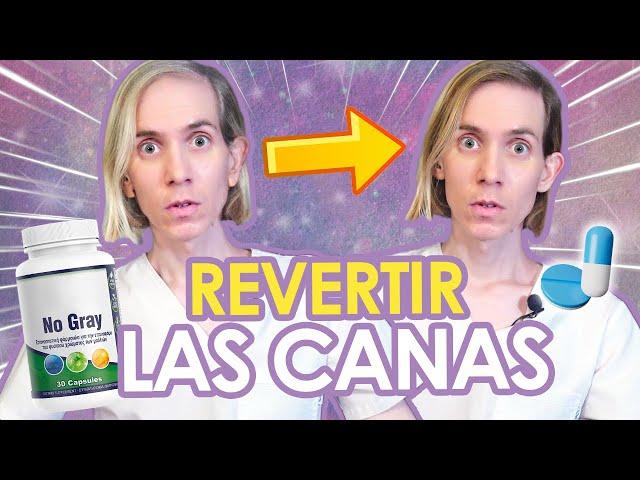 CANAS - ¿TIENEN SOLUCIÓN? - Como prevenirlas y tratarlas - LA VERDAD - Simon Scarano Dermatologo