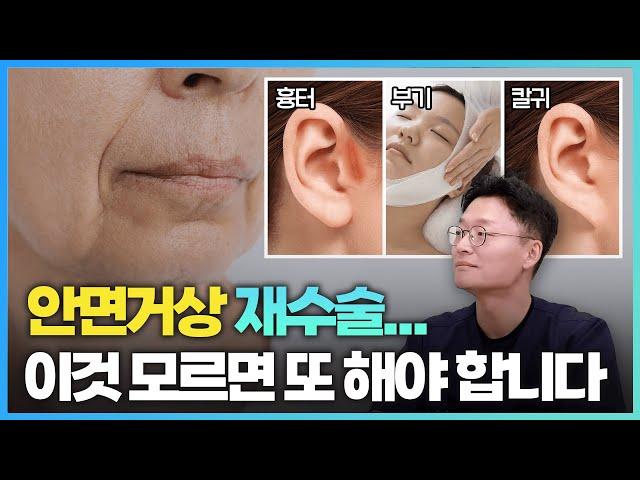안면거상 재수술에 대한 모든 것 (feat. 안면거상술 실패 원인)