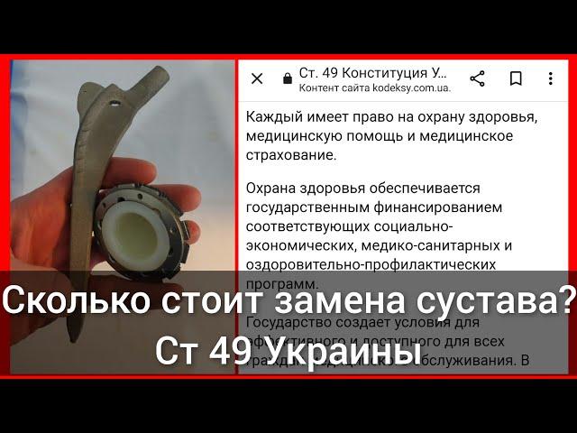 Сколько стоит замена сустава, эндопротез, эндопротезирование?