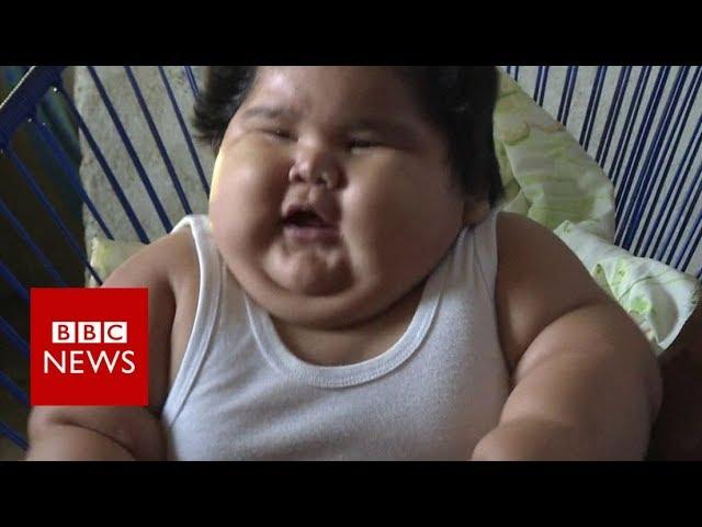 Why is this baby so overweight? - BBC News