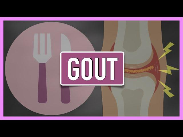 Gout | Emphasis on Diet/Nutrition