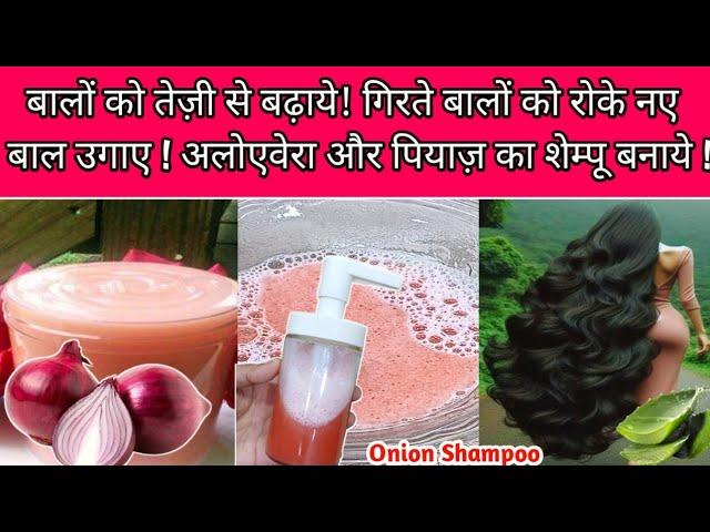 Onion Shampoo For Hair Fall | Strong Thick Long Hair | Kamzor Girty Balon K Liy Piyaz Shampoo