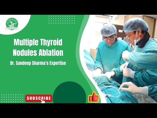 Multiple Thyroid Nodules Ablation by Dr. Sandeep Sharma | IRFACILITIES