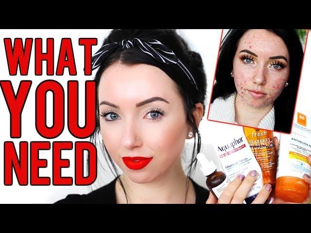 ACCUTANE STARTER KIT! Must-have Products while on Isotretinoin