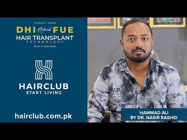 Hybrid FUE Hair Transplant with DHI Technology by Hair Club