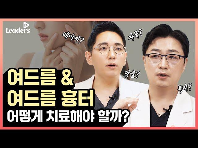 여드름 & 여드름 흉터 어떻게 치료해야 할까? I 보고 듣는 의학정보 · 리더스 TV