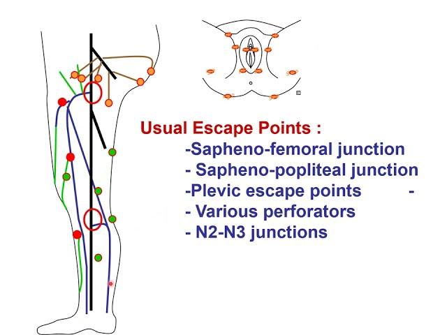 Venous hemodynamics physiopathology and treatments C.Franceschi BARI 2024