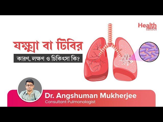 যক্ষ্মা বা টিবি রোগের কারণ, লক্ষণ ও চিকিৎসা কি? | Tuberculosis:Causes, Symptoms & Treatment