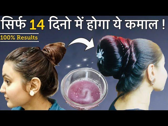 14 Days Extreme Hair Growth Challenge : Strongest Ingredient to Grow Hair Faster, Longer & Thicker️