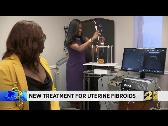 New treatment for uterine fibroids