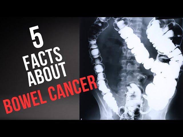 5 warning signs about Bowel Cancer you NEED to know