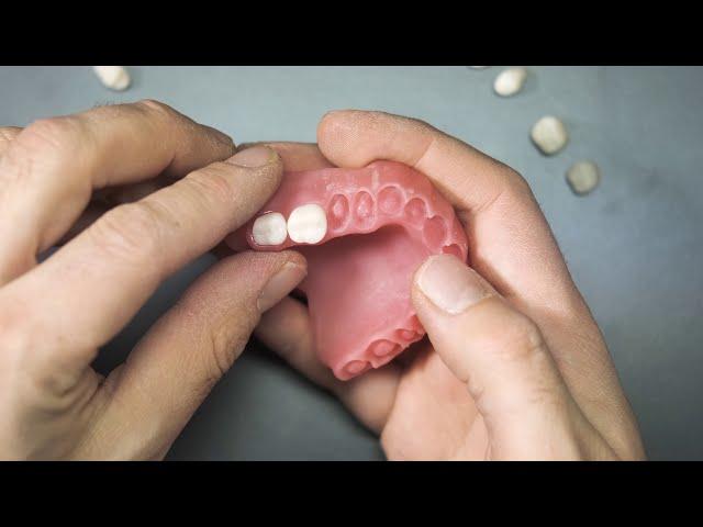 3D Printing Digital Denture with DentaFab 3D Printer and PowerResins Denture resin