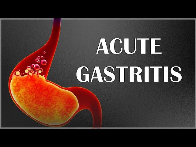 Acute Gastritis - Signs & Symptoms, Causes, Pathogenesis, Complications, Diagnosis & Treatment