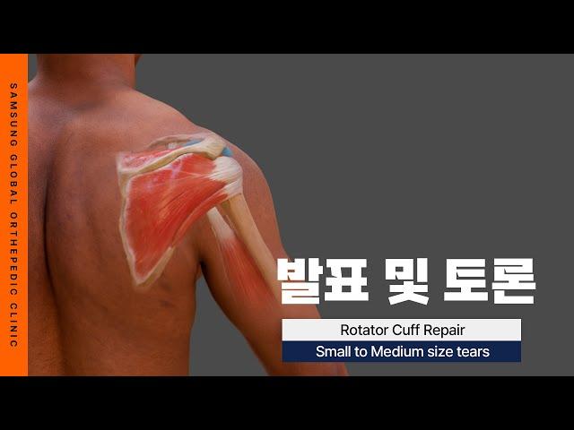 [SGOC 아카데미] Rotator Cuff Repair : Small to Medium Size Tears #회전근개파열 #관절경봉합술 #대구어깨수술 #대구어깨병원 #대구정형외과