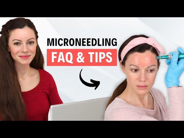 Microneedling FAQ & Must-Know Tips for Amazing Results