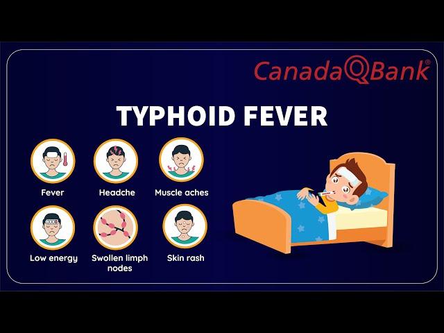 Typhoid Fever