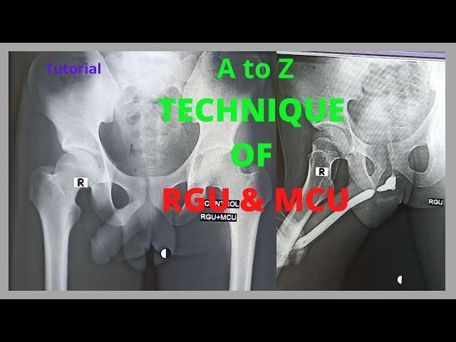 Technique of RGU & MCU (Ep-31) |Retrograde rethrogram and Micturating cystogram | Bangla Tutorial