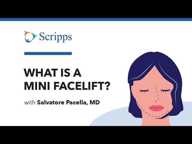 What Is a Mini Facelift with Salvatore Pacella, MD | San Diego Health