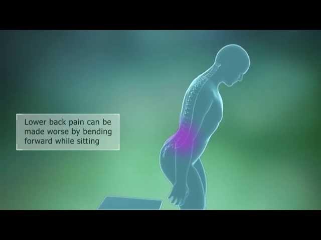 Lumbar Spondylosis Symptoms