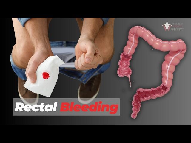 When to Be Worried About Rectal Bleeding