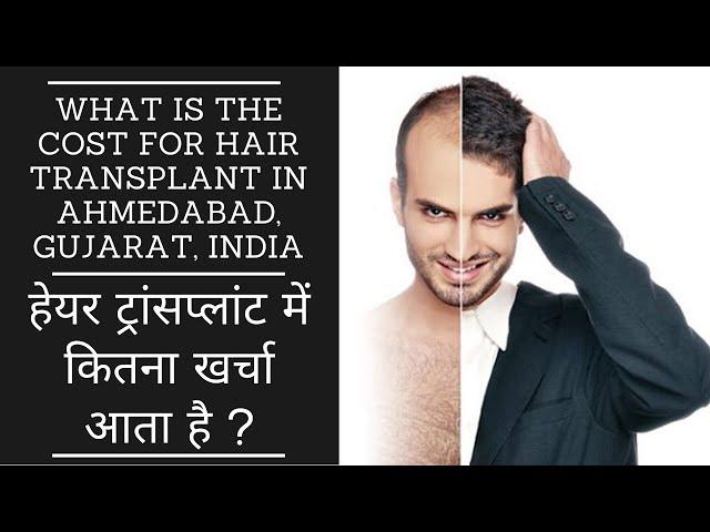 COST OF FUE HAIR TRANSPLANT IN AHMEDABAD, GUJARAT IN HINDI(हेयर ट्रांसप्लांट में कितना खर्चा आता है)