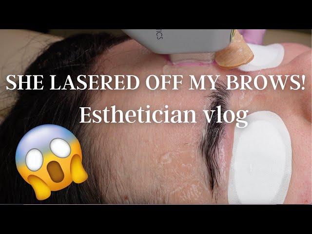 SHE LASERED MY BROWS OFF | Solo Esthetician vlog