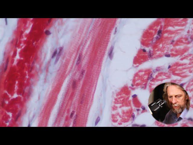 Microscopic anatomy of skeletal muscle