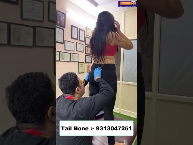 TAIL BONE | Chiropractic Treatment in Delhi | Dr. Varun | Call - 93130471251 #delhi #india #doctor